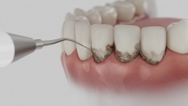 Trusted Tooth Extraction service in Park Ridge, IL - Dentist Open Now